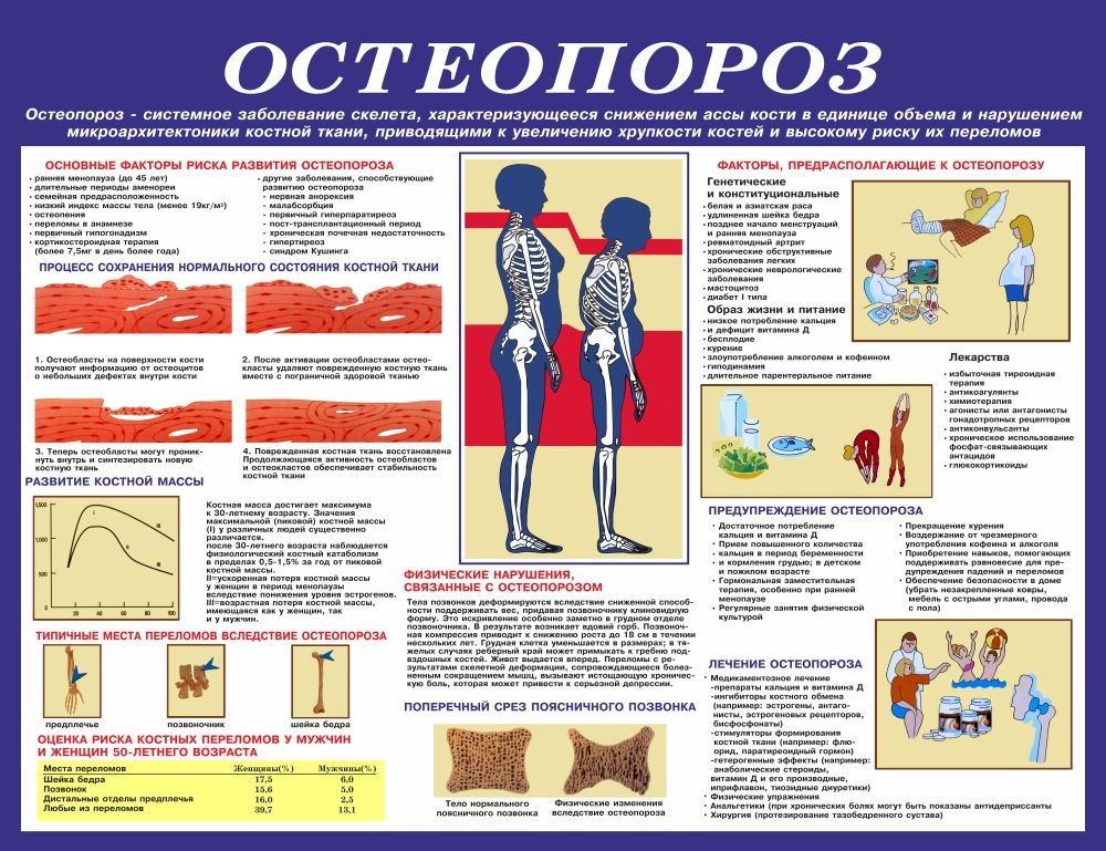 osteoporoz11012023