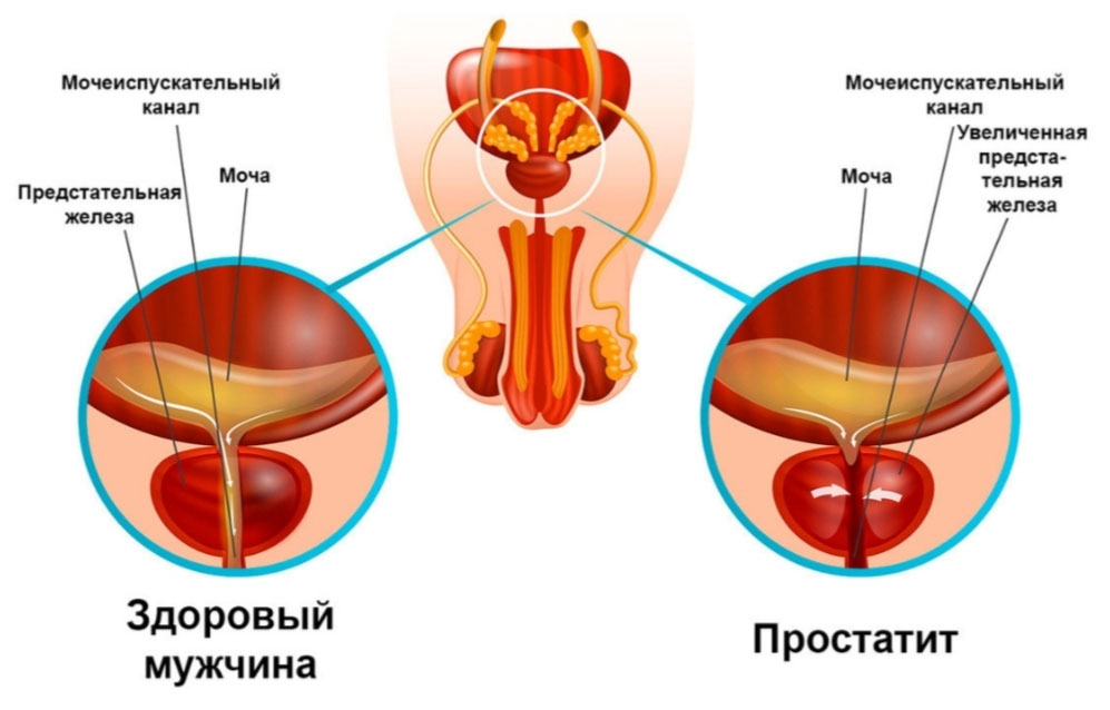 n 1 020525 1