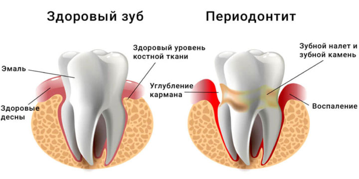 n1 120325 1